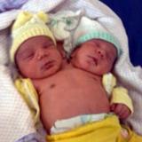 Brazilian Baby Born with Two Heads